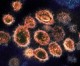 South African scientists detect new virus variant amid spike￼